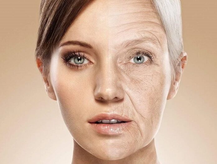 Pele facial antes e depois do rejuvenescimento a laser